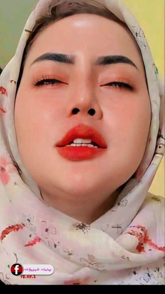 DP